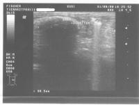 Ultraschall1