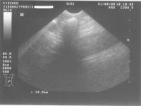 Ultraschall2
